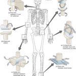 94 Synovial Joints – Anatomy And Physiology Within Joints Worksheet Answers
