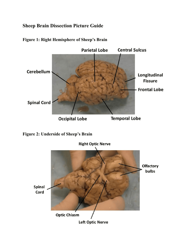Sheep Brain Dissection Picture Guide Together With Sheep Brain Dissection Worksheet