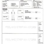 Collection Of Ankle Brachial Index Worksheet  Download Them And Try With Regard To Ankle Brachial Index Worksheet