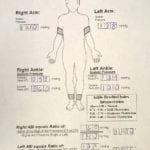 Hbs Regarding Ankle Brachial Index Worksheet